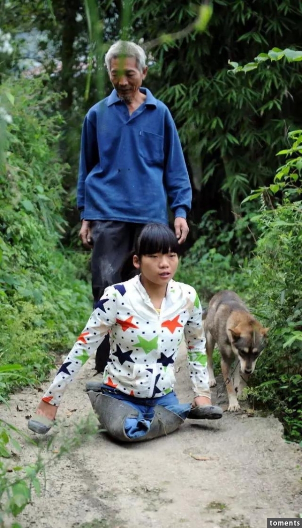 救媽媽她失去雙腿，13年以手代腳爬著上學，還幫​​父親撐起一個家